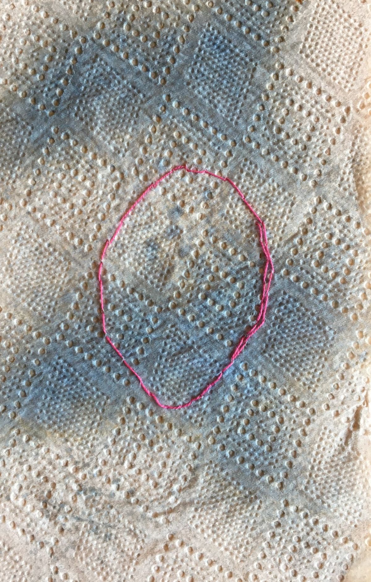 2- Thread with tissue