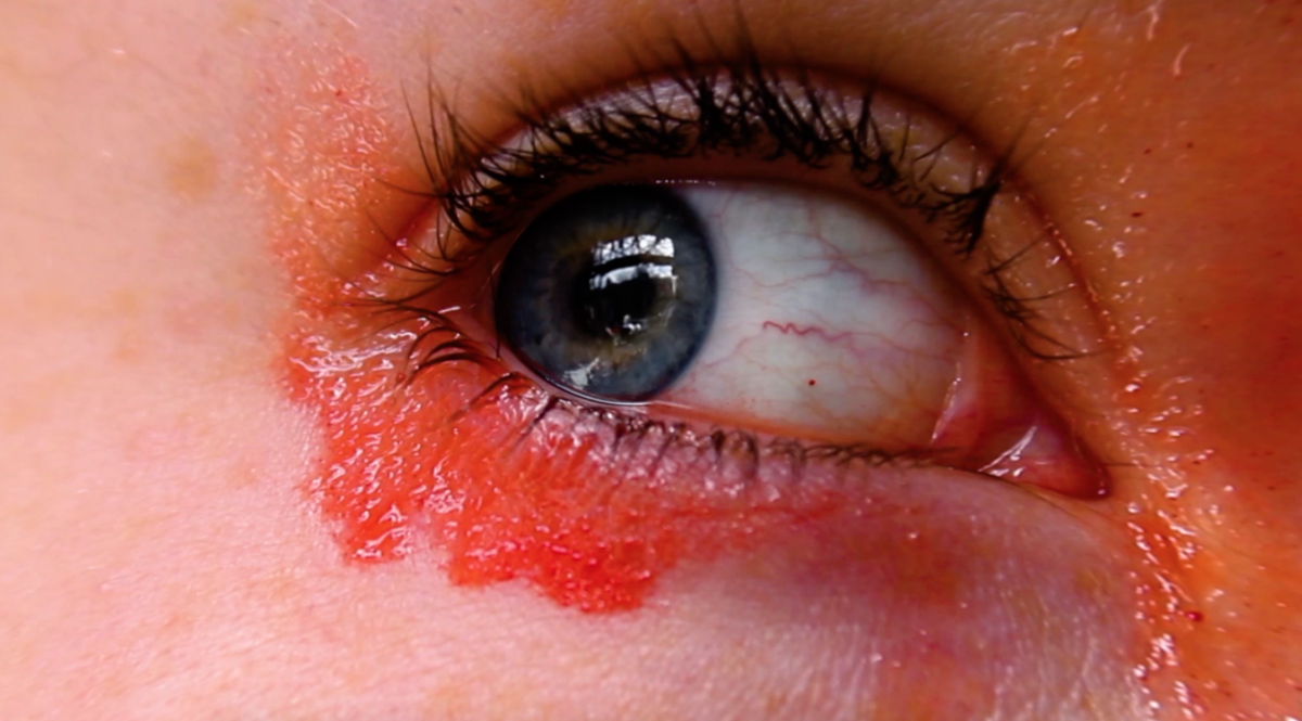 1- Video Screenshot, My bloody eye